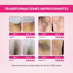 Crema Aclarante Skinglow®