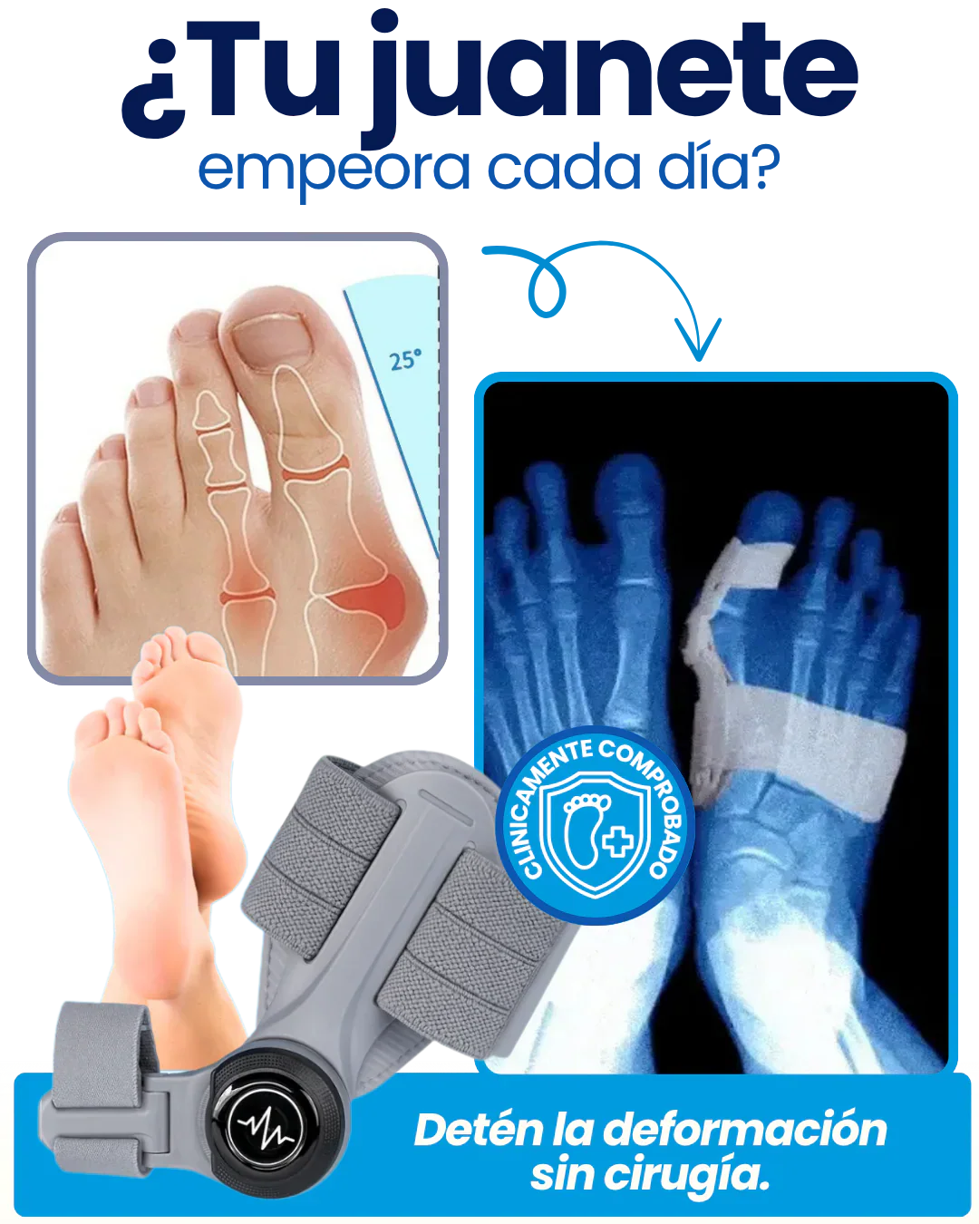 OrtoFix Pro™ Corrector de juanetes + Envío Gratis + Regalo 🎁